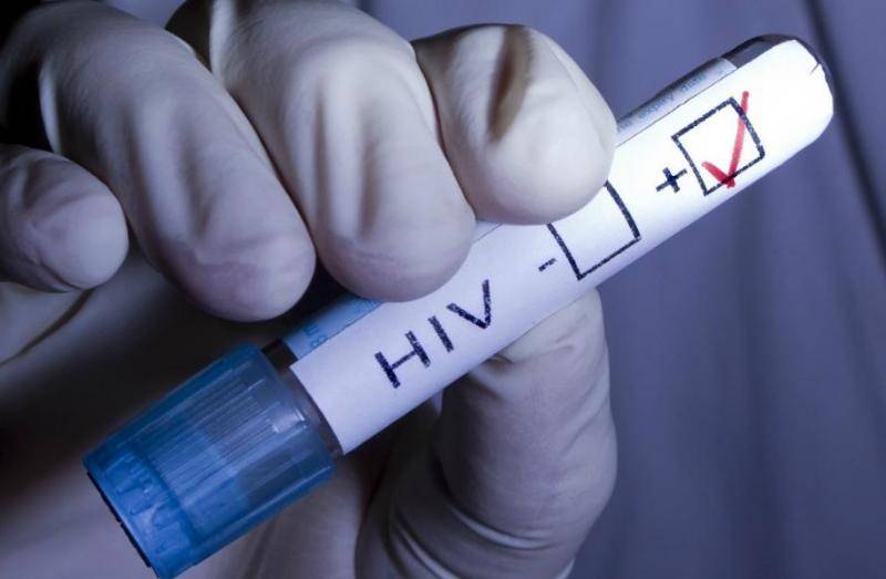 The number of HIV-infected in Russia exceeded one million people