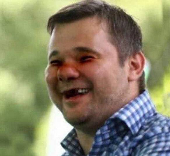 Без зубов, с синяками: глава администрации Зеленского опубликовал свое фото