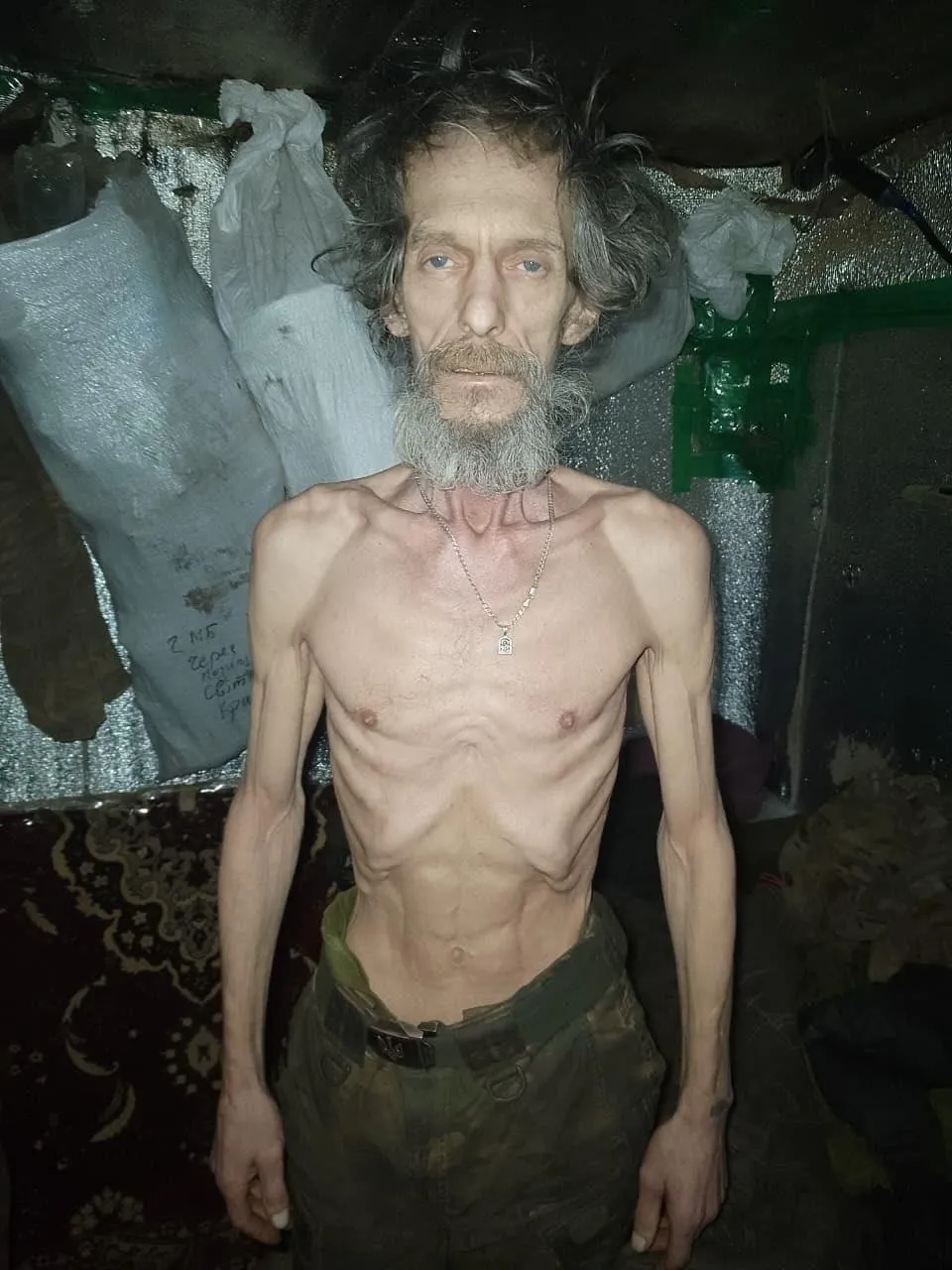 Кожа и кости: опубликованы фото боевиков ВСУ, просидевших в окопах несколько месяцев